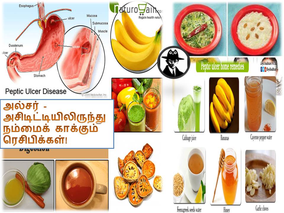 அல்சர் – அசிடிட்டியிலிருந்து நம்மைக் காக்கும் ரெசிபிக்கள்!