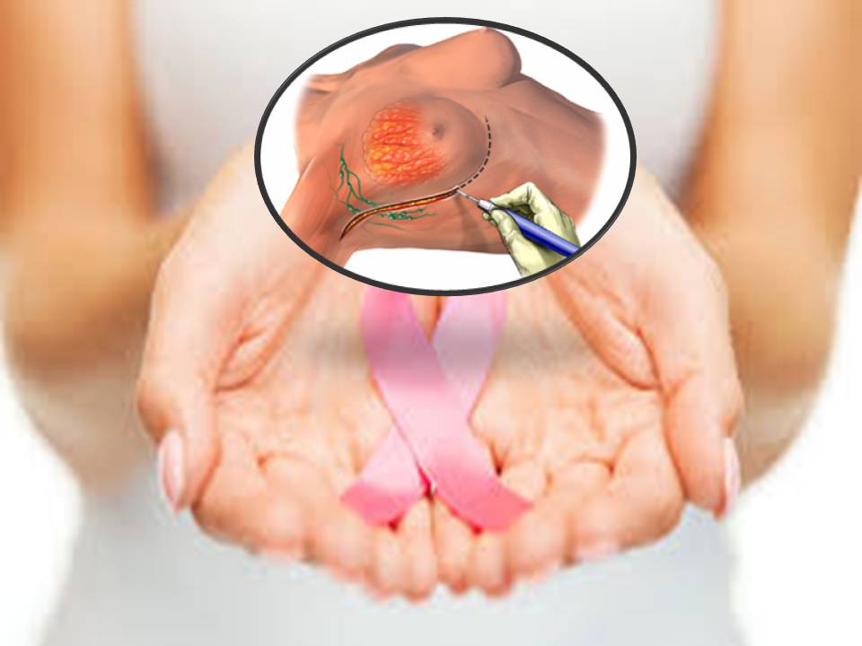 செயற்கை மார்பகம் பொருத்திக் கொண்ட  பெண்களுக்கு  புற்றுநோய்?