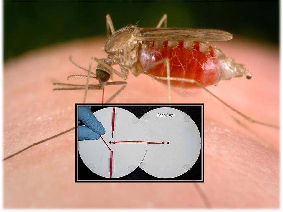 மலேரியா-வை கண்டுப் பிடிக்க  உதவும் படு சிம்பிள் கருவி!- வீடியோ