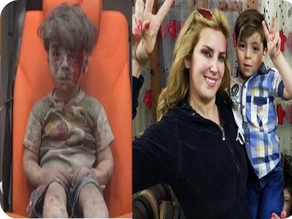 ‘அப்படி’ இருந்த சிரியா ஓம்ரான் இப்ப ‘ எப்படி ’ இருக்கான் தெரியுமா?