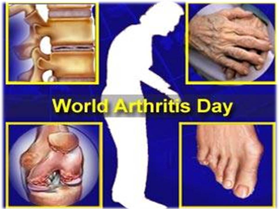 உலக ஆர்த்ரைடிஸ் தினம்!