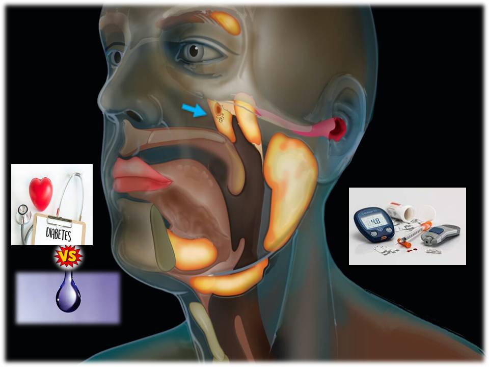 சர்க்கரை நோயை அடித்துத் துரத்தும் உமிழ்நீர்!