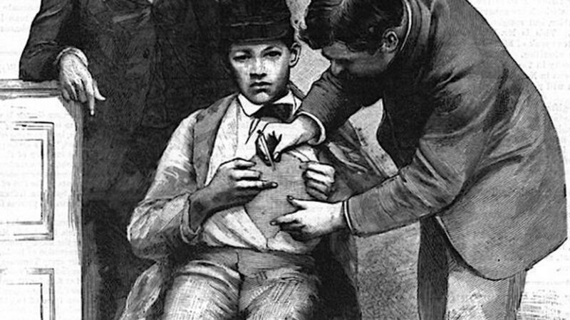 ஜோசப் மெய்சர் நினைவு நாள்- பாஸ்டரின் தடுப்பூசியின் முதல் மனிதப் பரிசோதனை நாயகன்!