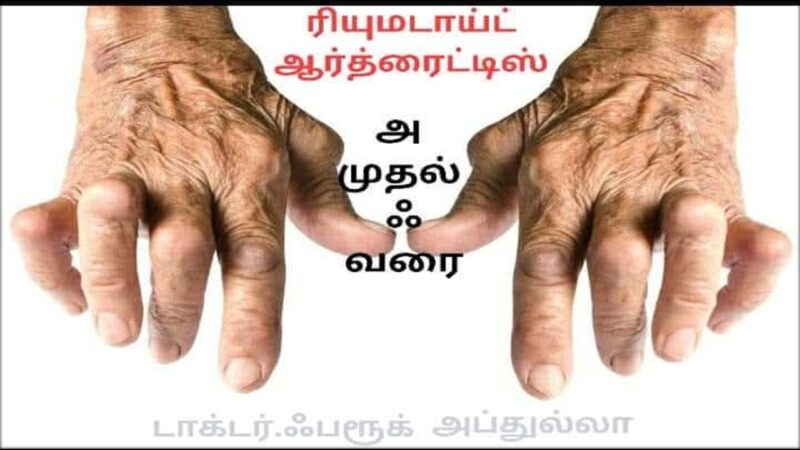 முடக்கு வாதம்: ஒரு விரிவான பார்வை (ரூமட்டாய்டு ஆர்த்ரைட்டிஸ்)!