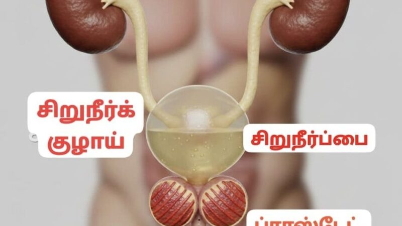 👨‍⚕️மிடில் ஏஜ் ஆண்களுக்கான அலர்ட்: ப்ராஸ்டேட் வீக்கமும், சிறுநீர்ப்பை தரும் எச்சரிக்கைகளும்!
