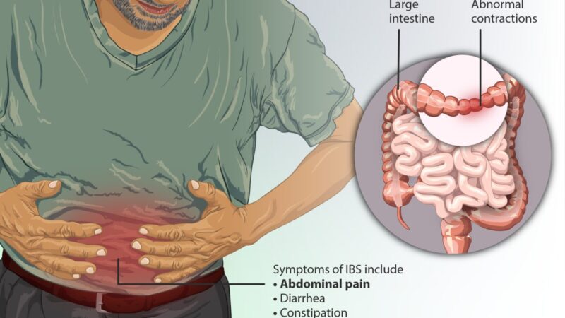 🚽இரிடபிள் பௌல் சிண்ட்ரோம் (IBS): வெறுப்பு தரும் குடல் கோளாறு – விளக்கம்!