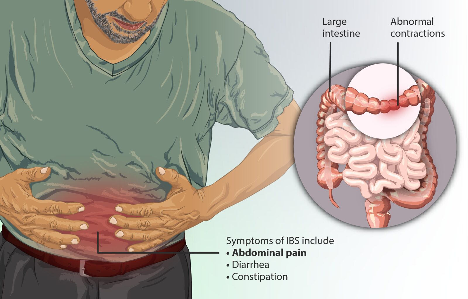 🚽இரிடபிள் பௌல் சிண்ட்ரோம் (IBS): வெறுப்பு தரும் குடல் கோளாறு – விளக்கம்!