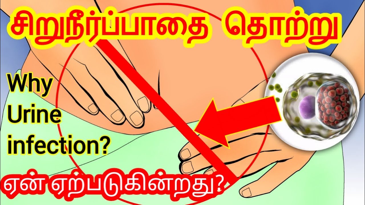சிறுநீர்ப்பாதை தொற்று ஏற்படுவதை தடுக்கலாமே!